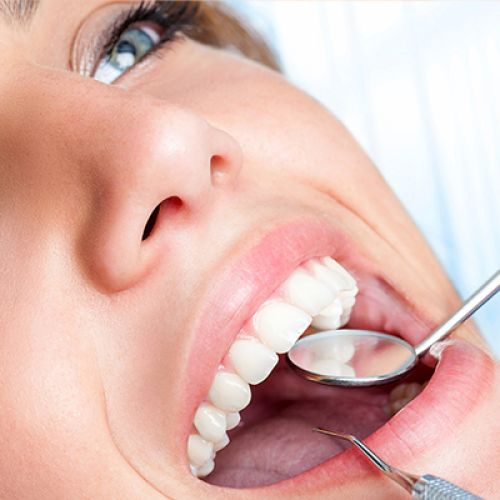 SCALE & POLISH dental treatment